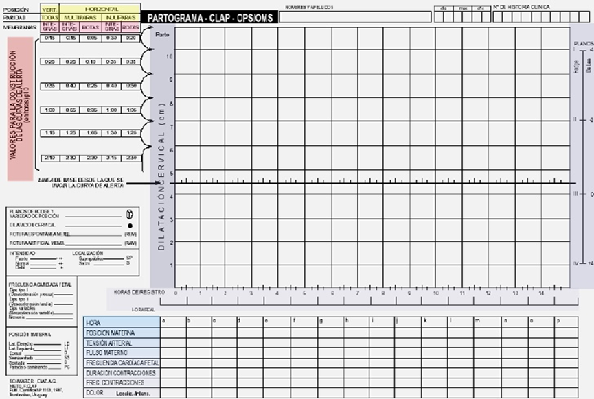 Resultado de imagen para partograma formato